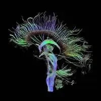 Ricostruzione trattografica delle connessioni neurali