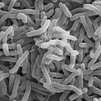 Vibrio cholerae al microscopio elettronico