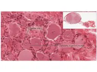 Cellule satelliti circondano i corpi cellulari di neuroni sensoriali