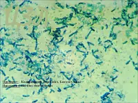 Bacillus thuringiensis al microscopio