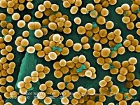 stafilococchi al microscopio a scansione