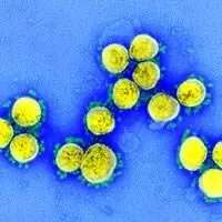 il virus SARS-CoV-2 isolato da un paziente