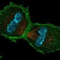 Telofase in cellula di topo. La foto è ottenuta grazie ad immunocolorazione. Le fibre del fuso sono arancioni, l'actina è verde mentre i cromtidi sono colorati in ciano