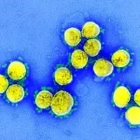 il virus SARS-CoV-2 isolato da un paziente