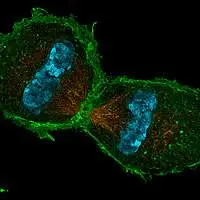 Telofase in cellula di topo. La foto è ottenuta grazie ad immunocolorazione. Le fibre del fuso sono arancioni, l'actina è verde mentre i cromtidi sono colorati in ciano