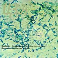 Bacillus thuringiensis al microscopio