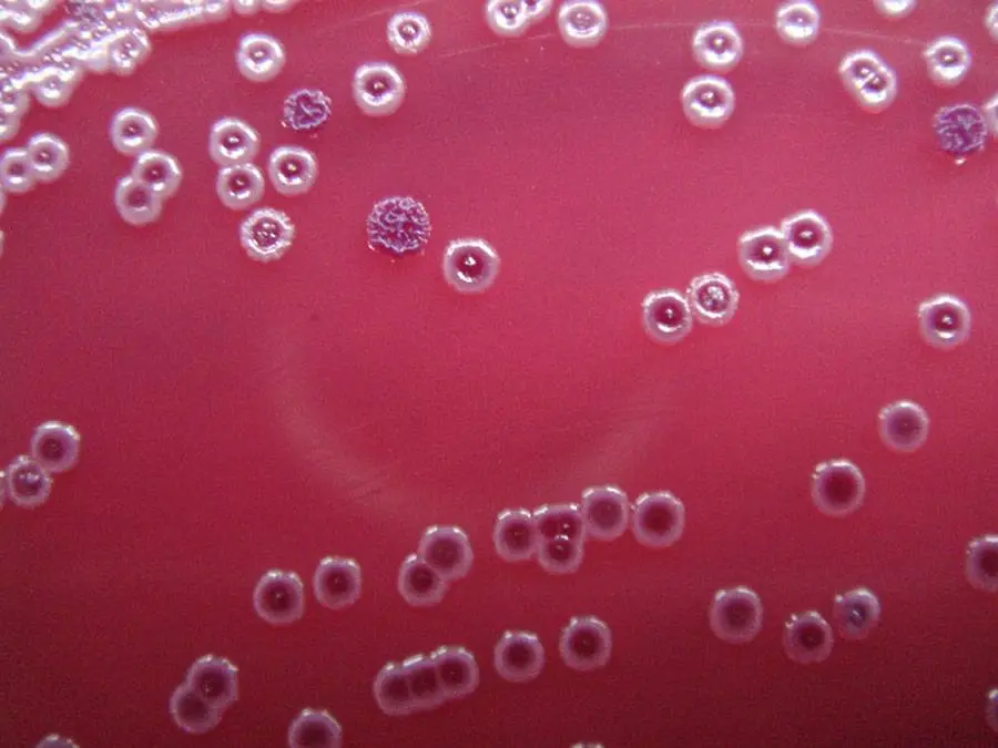 Colonie a diversa morfologia di Burkholderi pseudomallei