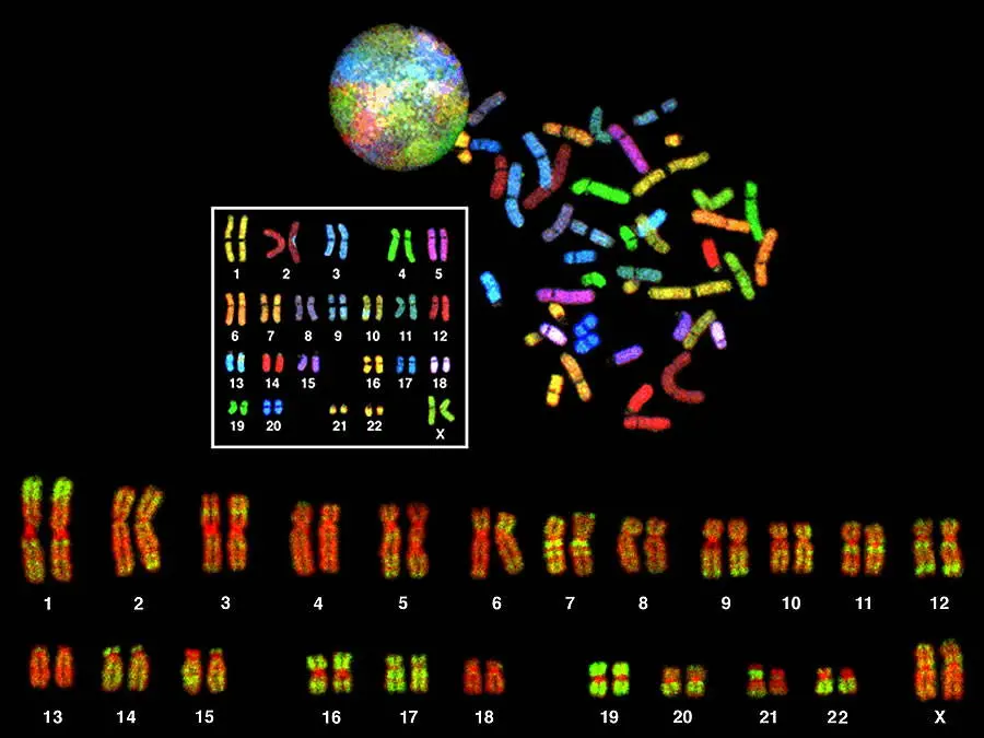 Combinazion di due immagini di cariotipi umani ottenuti con tecniche innovative