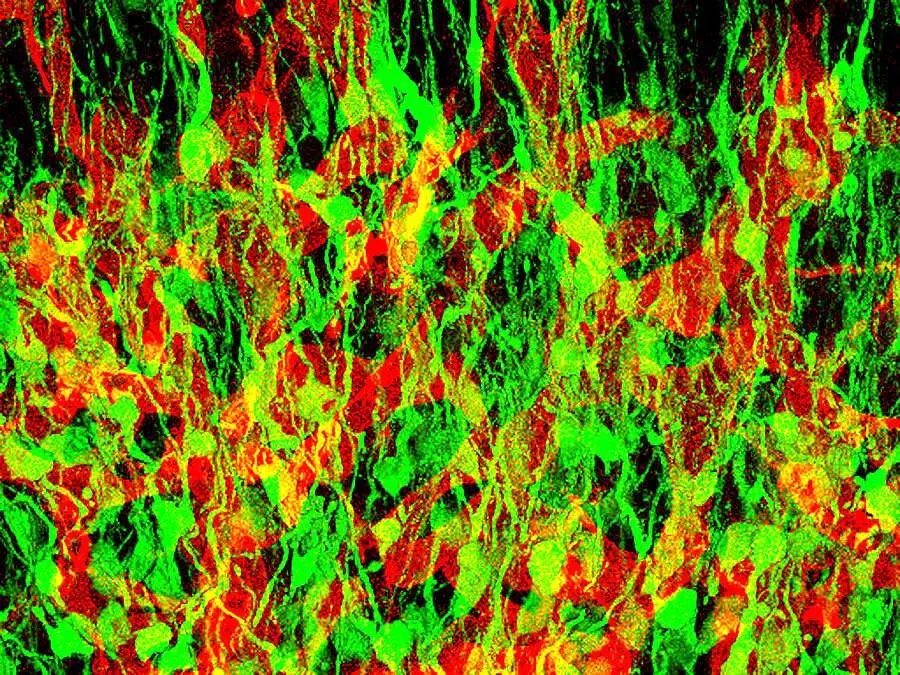 Cellule progenitrici di neuroni nel bulbo olfattivo di topo, colorate in verde
